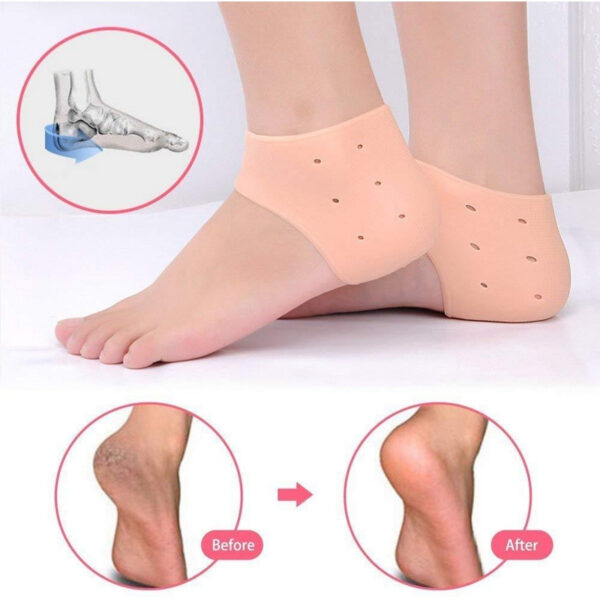 Heel Pain Anti Crack Silicone Care Set Trusti Product - Image 3